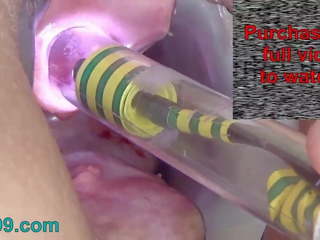 Endoscope الة تصوير إلى peehole امرأة بول ثقب لعب.