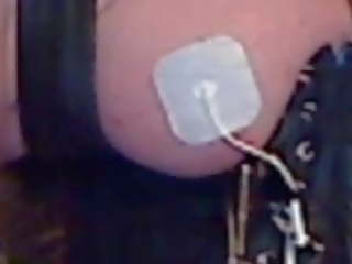 Electric stimulation of right breast